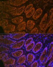 Anti-CEACAM6 antibody [ARC2110] used in IHC (Paraffin sections) (IHC-P). GTX05214