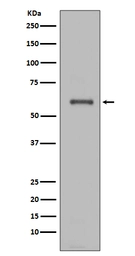 Anti-NOX4 antibody [E-14] used in Western Blot (WB). GTX05217