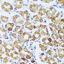 Anti-C1qC antibody used in IHC (Paraffin sections) (IHC-P). GTX05218