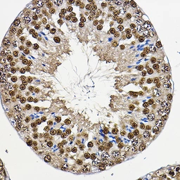 Anti-PER2 antibody used in IHC (Paraffin sections) (IHC-P). GTX05220
