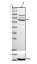 Anti-NOX4 antibody used in Western Blot (WB). GTX05223