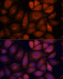 Anti-KIF13A antibody used in Immunocytochemistry/ Immunofluorescence (ICC/IF). GTX05224