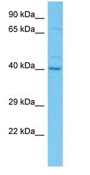 Anti-KLF2 antibody used in Western Blot (WB). GTX05228