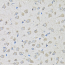 Anti-Proenkephalin antibody used in IHC (Paraffin sections) (IHC-P). GTX05231