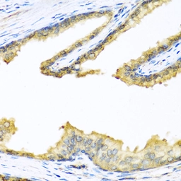 Anti-Proenkephalin antibody used in IHC (Paraffin sections) (IHC-P). GTX05231