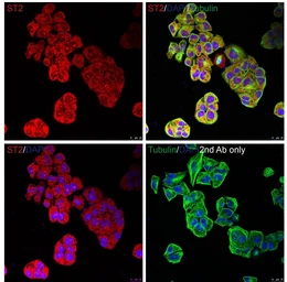 Anti-ST2 antibody used in Immunocytochemistry/ Immunofluorescence (ICC/IF). GTX05232