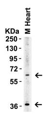 Anti-ST2 antibody used in Western Blot (WB). GTX05232