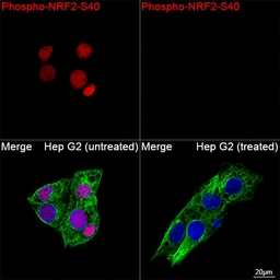 Anti-NRF2 (phospho Ser40) antibody [ARC0283] used in Immunocytochemistry/ Immunofluorescence (ICC/IF). GTX05239