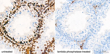 Anti-NRF2 (phospho Ser40) antibody [ARC0283] used in IHC (Paraffin sections) (IHC-P). GTX05239