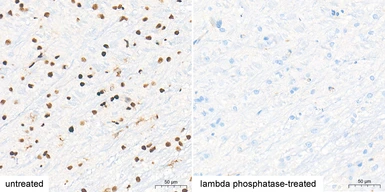 Anti-NRF2 (phospho Ser40) antibody [ARC0283] used in IHC (Paraffin sections) (IHC-P). GTX05239