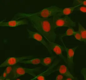 Anti-CtIP antibody used in Immunocytochemistry/ Immunofluorescence (ICC/IF). GTX05240