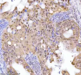 Anti-CtIP antibody used in IHC (Paraffin sections) (IHC-P). GTX05240