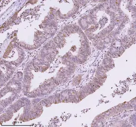 Anti-CtIP antibody used in IHC (Paraffin sections) (IHC-P). GTX05240