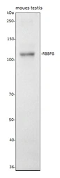 Anti-CtIP antibody used in Western Blot (WB). GTX05240