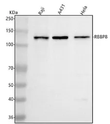 Anti-CtIP antibody used in Western Blot (WB). GTX05240