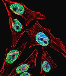Anti-TERT antibody used in Immunocytochemistry/ Immunofluorescence (ICC/IF). GTX05257