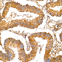 Anti-LAP3 antibody [ARC71182] used in IHC (Paraffin sections) (IHC-P). GTX05261