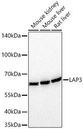 Anti-LAP3 antibody [ARC71182] used in Western Blot (WB). GTX05261