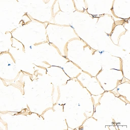 Anti-ATGL antibody [ARC80388] used in IHC (Paraffin sections) (IHC-P). GTX05269