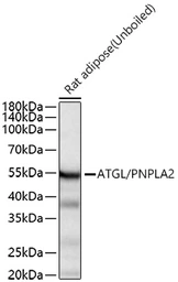 Anti-ATGL antibody [ARC80388] used in Western Blot (WB). GTX05269