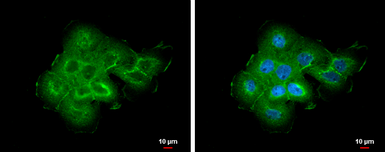 Anti-ABR antibody [C3], C-term used in Immunocytochemistry/ Immunofluorescence (ICC/IF). GTX100031