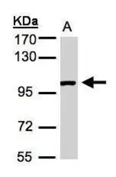 Anti-ABR antibody [C3], C-term used in Western Blot (WB). GTX100031