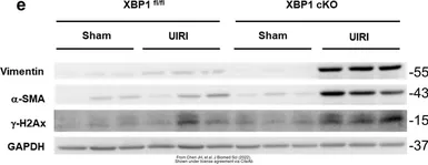 Anti-alpha Smooth Muscle Actin antibody used in Western Blot (WB). GTX100034