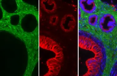 Anti-alpha Smooth Muscle Actin antibody used in IHC (Paraffin sections) (IHC-P). GTX100034
