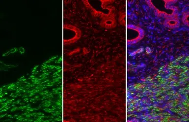 Anti-alpha Smooth Muscle Actin antibody used in IHC (Paraffin sections) (IHC-P). GTX100034
