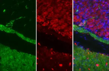 Anti-alpha Smooth Muscle Actin antibody used in IHC (Paraffin sections) (IHC-P). GTX100034