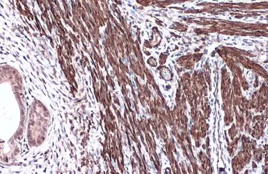 Anti-alpha Smooth Muscle Actin antibody used in IHC (Paraffin sections) (IHC-P). GTX100034