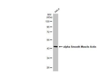 Anti-alpha Smooth Muscle Actin antibody used in Western Blot (WB). GTX100034