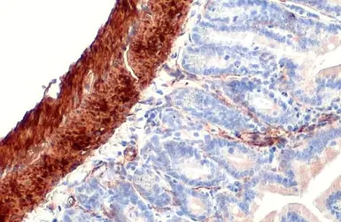Anti-alpha Smooth Muscle Actin antibody used in IHC (Paraffin sections) (IHC-P). GTX100034