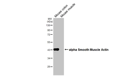 Anti-alpha Smooth Muscle Actin antibody used in Western Blot (WB). GTX100034