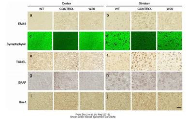 Anti-Iba1 antibody used in (). GTX100042