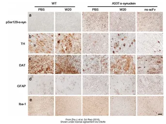 Anti-Iba1 antibody used in (). GTX100042