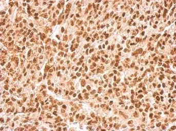 Anti-APE1 antibody [N1], N-term used in IHC (Paraffin sections) (IHC-P). GTX100050