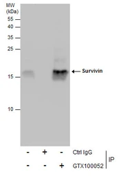 Anti-Survivin antibody used in Immunoprecipitation (IP). GTX100052