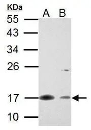 Anti-Survivin antibody used in Western Blot (WB). GTX100052