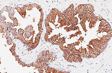 Anti-PSA antibody [C2C3], C-term used in IHC (Paraffin sections) (IHC-P). GTX100054