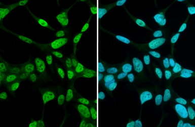 Anti-Androgen Receptor antibody [N1], N-term used in Immunocytochemistry/ Immunofluorescence (ICC/IF). GTX100056
