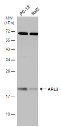 Anti-ARL2 antibody used in Western Blot (WB). GTX100060