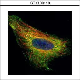 Anti-TIP30 antibody used in Immunocytochemistry/ Immunofluorescence (ICC/IF). GTX100119