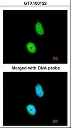 Anti-ERCC8 antibody used in Immunocytochemistry/ Immunofluorescence (ICC/IF). GTX100122