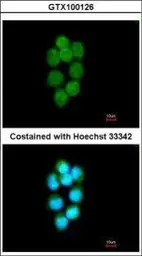 Anti-TDP1 antibody [N1N3] used in Immunocytochemistry/ Immunofluorescence (ICC/IF). GTX100126