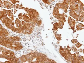 Anti-TDP1 antibody [N1N3] used in IHC (Paraffin sections) (IHC-P). GTX100126
