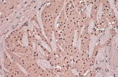 Anti-DDB1 antibody used in IHC (Paraffin sections) (IHC-P). GTX100130