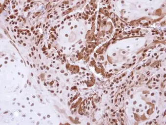 Anti-DDB1 antibody used in IHC (Paraffin sections) (IHC-P). GTX100130