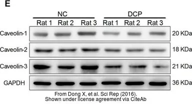 Anti-Caveolin 1 antibody [N1N3] used in Western Blot (WB). GTX100205