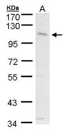 Anti-CLCA1 antibody [C1C2], Internal used in Western Blot (WB). GTX100217